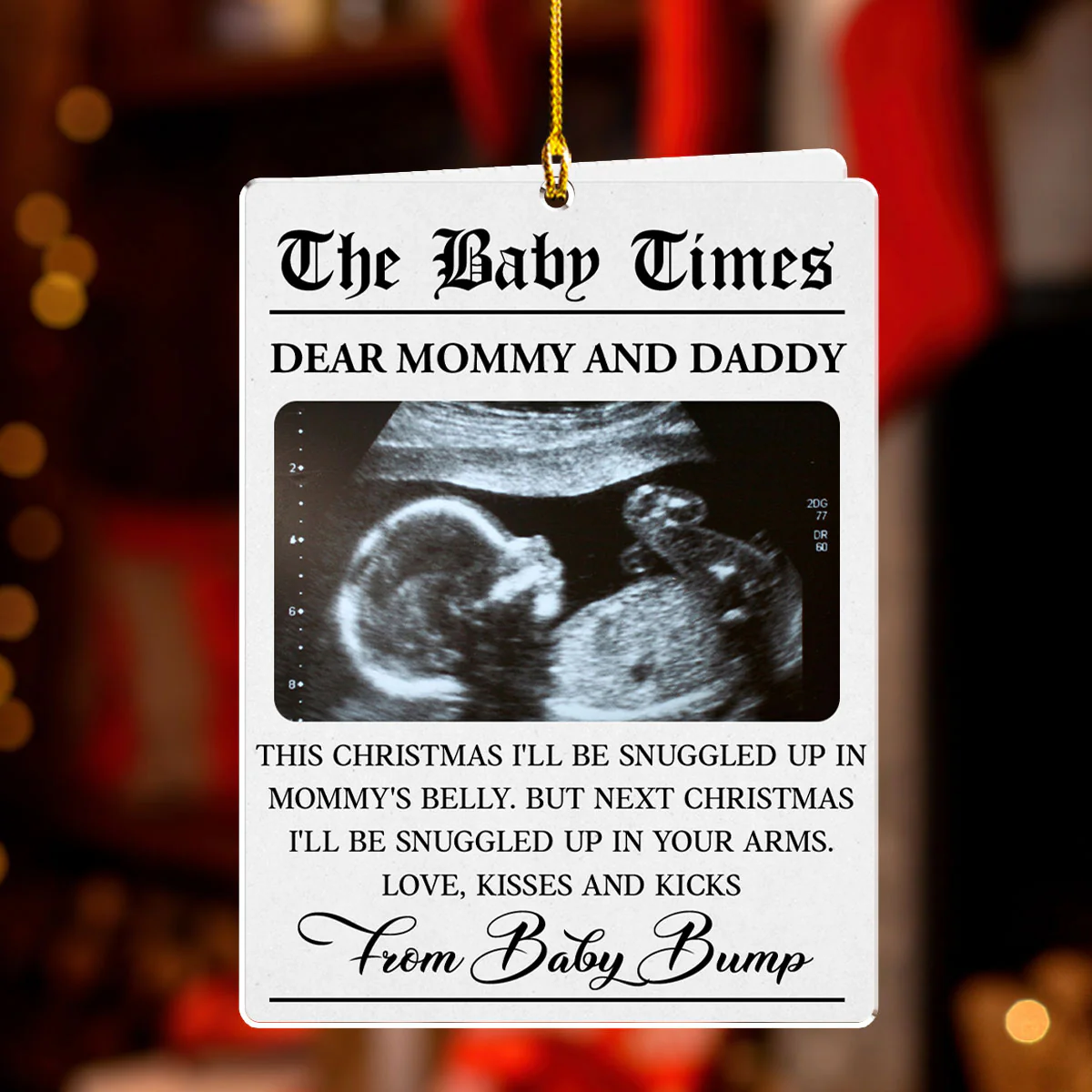 The Baby Times - Personalized Custom Acrylic Ornament - Image 2